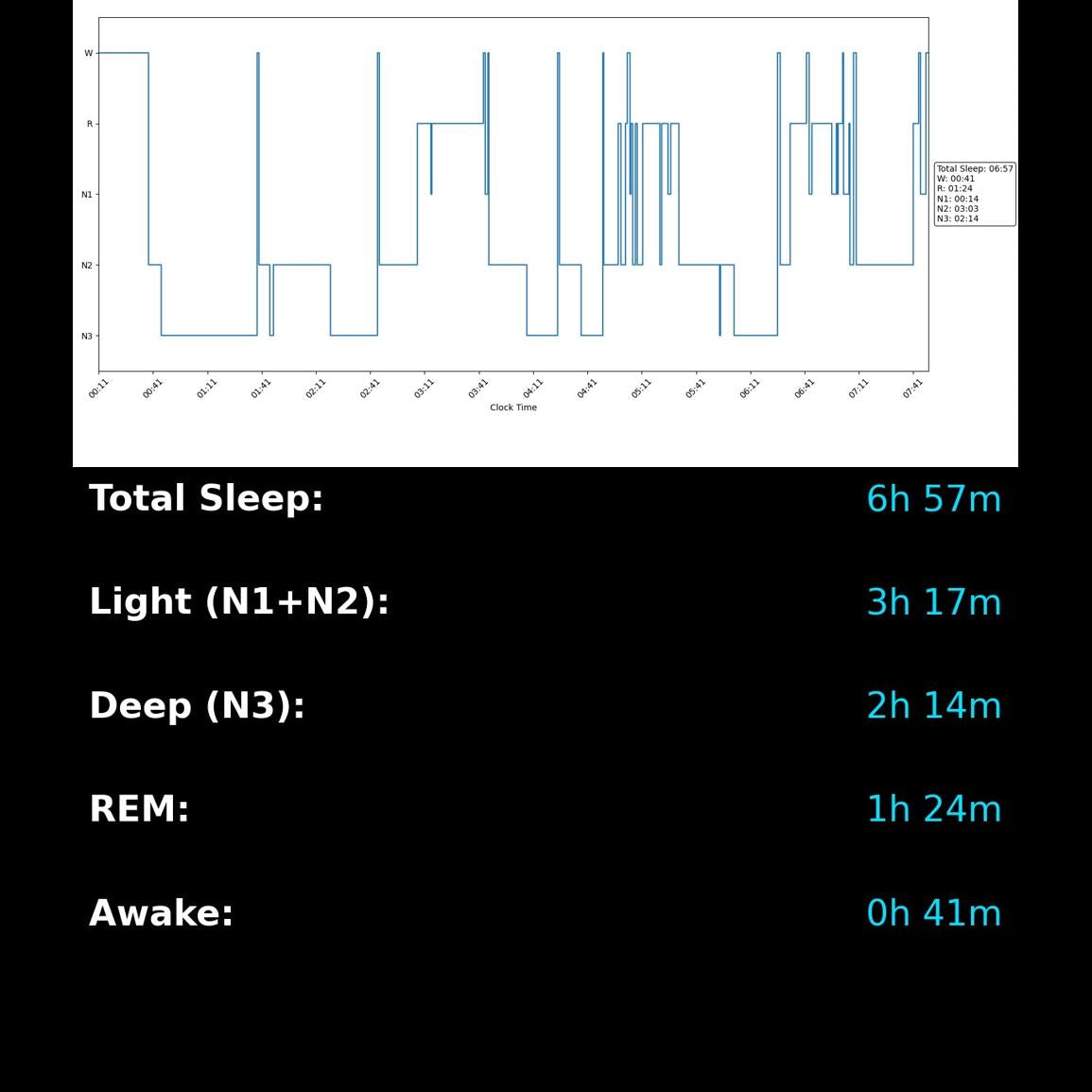 AiON EEG | Brainwave Recording Kit