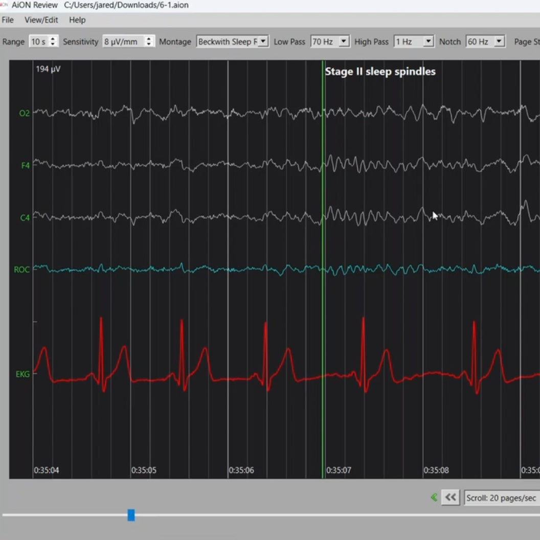 AiON EEG | Brainwave Recording Kit